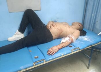 CASI LO MATAN DE UN MACHETAZO POR AMOR