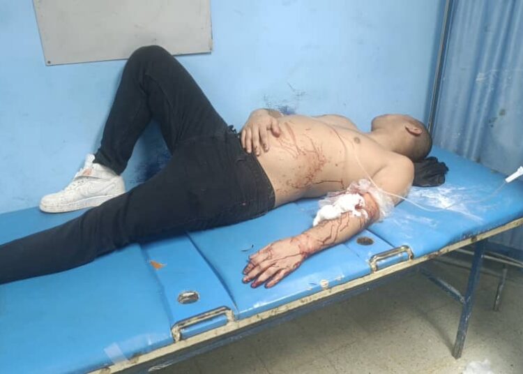 CASI LO MATAN DE UN MACHETAZO POR AMOR